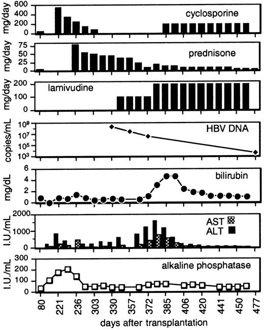 Fig. 1. Profile of serum bilirubin, liver enzymes, plasma HBV DNA viral load, and immunosuppression after transplantation.