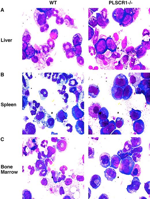 Fig. 6. Impaired myeloid differentiation of PLSCR1−/−hematopoietic precursor cells. / Newborn (day 1) liver cells (A), adult spleen cells (B), and adult bone marrow cells (C), were cultured in MethoCult 3234 supplemented with 20 ng/mL SCF and 60 ng/mL G-CSF for either 8 (liver), 10 (spleen), or 7 (bone marrow) days, respectively. The cells were washed and transferred to glass slides by cytospin and stained with Wright-Giemsa solution. Slides were examined at × 1000 magnification.