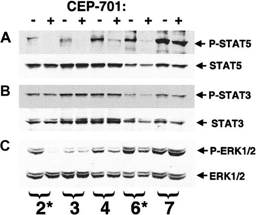 Fig. 7. Response of STAT5, STAT3, and ERK1/2 to CEP-701–mediated inhibition of FLT3 in primary AML blasts. / Whole cell extract (50 μg/sample) from the experiment shown in Figure6 was available for 5 of the 8 patient samples (numbering is the same as in Figure 6). Samples were electrophoresed and transferred to membrane, then the membrane was probed, stripped, and reprobed serially with the designated antibodies (A) upper, phosphorylated STAT5; lower, STAT5. (B) Upper, phosphorylated STAT3; lower, STAT3. (C) Upper, phosphorylated ERK1/2; lower- ERK1/2. Those samples found by RT-PCR to harbor a FLT3/ITD mutation are denoted with an asterisk.