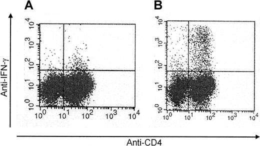 Fig. 1. Enrichment for CMV-specific CD4+ T cells following repetitive stimulation with CMV antigen. / CMV protein–specific CD4+ T cells generated by repetitive stimulation with CMV antigen were analyzed by intracellular IFN-γ staining by flow cytometry after stimulation with CMV antigen (representative example of a T-cell line analyzed after 2 stimulations) (A, day 0; B, day 14).
