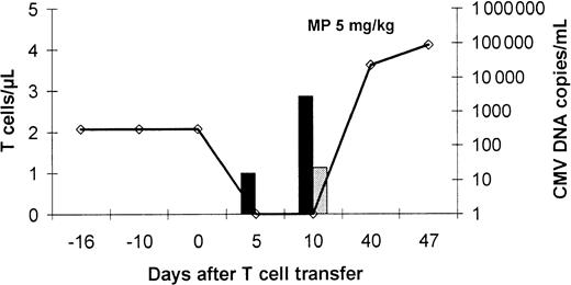 Fig. 6. Limited antiviral effect of T-cell therapy in a patient receiving high-dose corticosteroids. / Patient no. 8 demonstrated an impressive expansion of CMV protein-specific CD4+ T cells after T-cell transfer associated with recovery of CMV peptide-specific CD8+ T cells already on day +10 after T-cell therapy and clearance of the viral DNA from the blood. After initiation of high-dose corticosteroid treatment for relapse of the underlying disease, a rapid increase of the virus load was observed. Peptide- and protein-specific T cells were analyzed by intracellular IFN-γ staining by flow cytometry after specific stimulation. Virus load was assessed by quantitative PCR (determined as virus copies/mL blood). The line represents the CMV-DNA load in the blood (virus copies/mL blood), the dark bars represent the number of circulating CMV protein-specific CD4+ T cells, and the gray bars represent the number/μL blood of circulating CD8+ T cells specific for the GPISHGHVLK CMV peptide, which represents the immunodominant epitope in HLA A*1101-positive individuals.