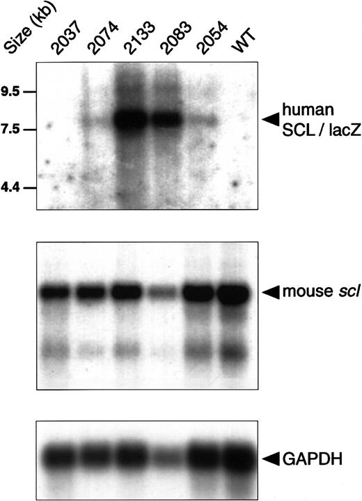 Fig. 2. Expression of the human. / SCL gene. Northern analysis of poly(A)+ RNA from E14.5 fetal liver hybridized with a lacZ probe to detect expression of the human SCL/lacZ transgene, a 3′ UTR probe for endogenous mouse scl, and a GAPDH probe as a control for mRNA loading. RNA was obtained from the indicated transgenic lines as well as from a wild-type control (WT).