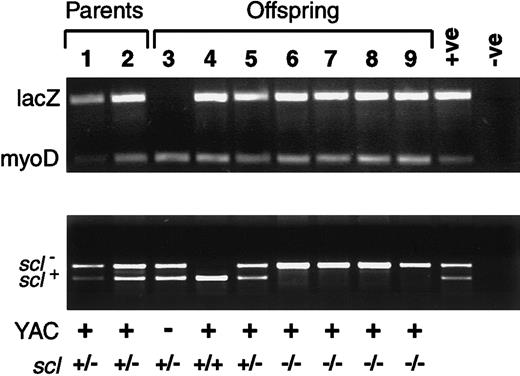 Fig. 3. The human SCL YAC completely rescues the. / scl−/− embryonic lethal phenotype.PCR genotype analysis of offspring derived from interbreeding YAC+/−scl+/− male and YAC+/−scl+/− female mice from line 2074. Lanes 1 and 2, YAC+/−scl+/−male and female parents; lanes 3 to 9, offspring with the following genotypes: 3, (YAC−scl+/−); 4, (YAC+scl+/+); 5, (YAC+scl+/−); 6-9, (YAC+scl−/−); +ve, positive control (YAC+ scl+/−); −ve, no DNA control.