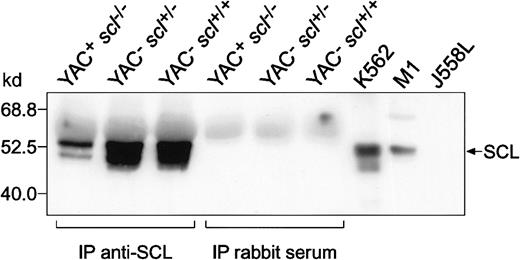 Fig. 4. Detection of human SCL protein in rescued YAC+. / scl−/− E14.5 fetal liver. Cell lysates were prepared from E14.5 fetal livers obtained from transgenic (line 2054) and nontransgenic mice. These were immunoprecipitated (IP) with rabbit antimouse SCL antisera or preimmune rabbit serum as indicated. The immunoprecipitates were subsequently Western blotted using an antimouse SCL antibody raised in sheep. Lysates from SCL-expressing cell lines (K562, human erythroleukemia; M1, mouse myeloid leukemia) and an SCL-nonexpressing cell line (J558L, mouse plasmacytoma) were included on the immunoblot as controls.