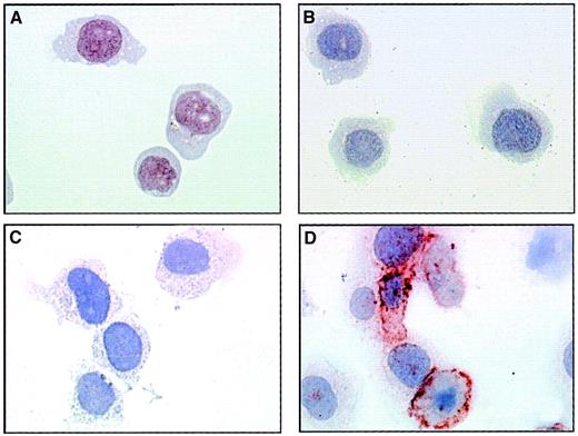 Fig. 3. EMP binding to THP-1 cells. / THP-1 cells incubated with EMPs for 15 minutes (C, D) or control THP-1 cells (A, B) were immunostained according to the avidin–biotin–peroxidase procedure and analyzed by microscopy as described in “Materials and methods.” Primary antibody was 3End mAbs (B, D) or isotype-matched control (A, C) used at 50 μg/mL. The ratio of EMP to THP-1 cells was 50:1. Brown coloration on THP-1 cells incubated with EMPs indicated the presence of endothelial antigens. Observations are representative of 4 independent experiments. Original magnification: × 50.