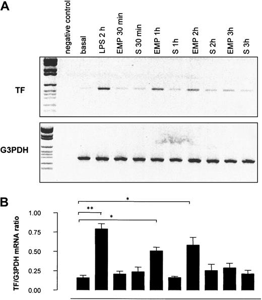 Fig. 9. Effect of EMPs on TF gene transcription in THP-1 cells. / THP-1 cells were incubated with EMPs or EMP free-supernatant (S) for 30 minutes to 3 hours, and TF mRNA expression in THP-1 cells was assessed using RT-PCR. THP-1 cells stimulated with LPS for 2 hours were used as positive controls. (A) Representative ethidium bromide visualization of PCR-amplified products of TF and G3PDH mRNA after agarose gel electrophoresis. Band intensity was measured by densitometry. (B) Relative values of TF mRNA normalized to G3PDH mRNA. Values are mean ± SD (n = 5). *P < .05; **P < .01.