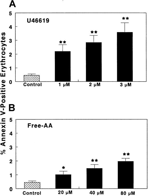 Fig. 5. Effect of eicosanoids on annexin-V binding to erythrocytes. / WB was diluted (1:40; vol/vol) with HEPES buffer and then CaCl2 was added (final Ca++ concentration, 1.5 mM) (“Materials and methods”). Different concentrations of either AA, U46 619, 12-HETE, PGI2, or appropriate solvent controls were added. Ca++-ionophore A23 187 and ionomycin were used as positive controls. Samples were kept without stirring (5 minutes, 22°C) and then FITC–annexin-V or PE–antiglycophorin-A antibodies were added. The samples were kept undisturbed (10 minutes, 4°C, dark) (“Materials and methods”). Samples were quench-diluted with ice-cold HEPES (with 1.5 mM Ca++) at 4°C and examined immediately by flow cytometry (“Materials and methods”). The TXA2-analog U46 619 and free AA dose dependently increased annexin-V binding to erythrocytes (n = 12). In the same time frame, Ca++-ionophore A23 187 (1 μM) induced annexin binding in 8.4% ± 1.03 erythrocytes (n = 17). Ionomycin 1 μM yielded PS exposure in 1.91% ± 0.19% of erythrocytes (n = 10). PGI2 (0.5-1 μM) or 12-HETE (0.1-1 μM) did not induce annexin-V binding (not shown). Results are expressed as mean ± SEM (%) of erythrocytes that bind annexin-V; n = number of different donors studied. *P < .05; **P < .001. Significance was determined by Studentt test.