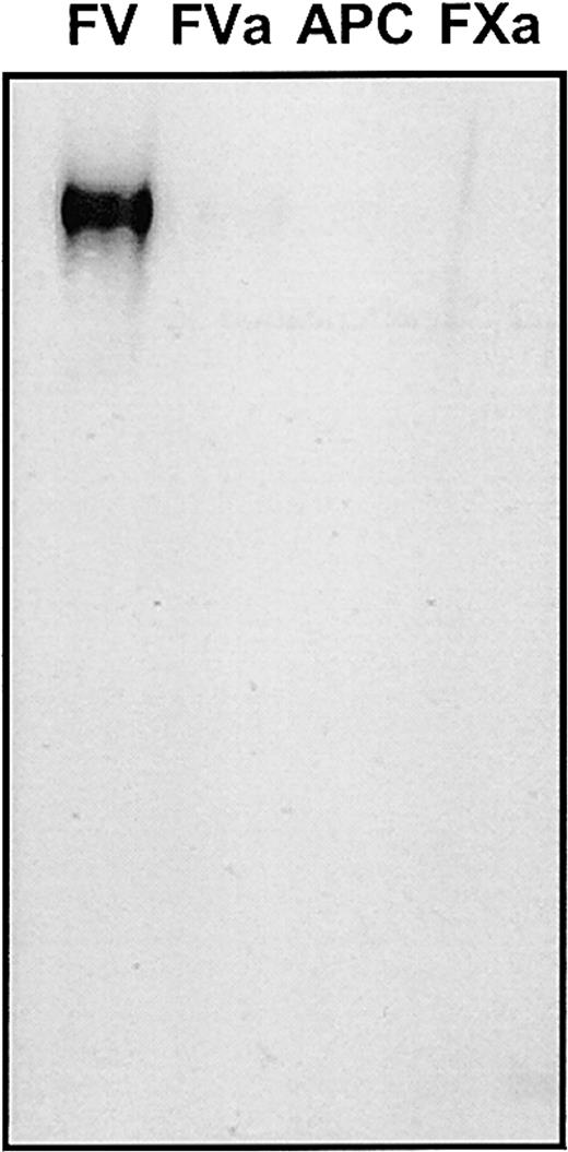 Fig. 2. Patient plasma contains an antifactor V antibody. / All components of prothrombinase (factor V, factor Va, factor Xa) as well as APC were analyzed nonreduced on a 5% to 15% SDS-PAGE followed by transfer to nitrocellulose (approximately 1.5 μg of each protein was applied per lane). The isolated total immunoglobulin fraction from the patient's plasma (eluted from the protein G–Sepharose column) was used as a source of primary antibody (at a concentration of 500 μg/mL) and staining of the proteins was accomplished with an antihuman immunoglobulin coupled to horseradish peroxidase (1:5000 dilution) and chemiluminescence. The lane assignment is indicated on the top of the figure. Control experiments were performed using a purified immunoglobulin fraction from normal plasma.