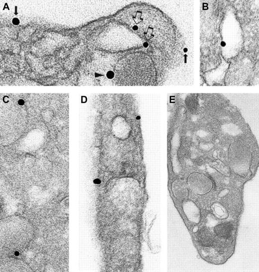 Fig. 6. Ultrastructural immunonanogold localization of syntaxin 2 in unstimulated human platelets. / (A) α-Granule (arrowhead), OCS (open arrows), and plasma membranes (solid arrows) are labeled. Another OCS membrane (B), several α-granule membranes (C), and plasma membrane (D) labeled with silver-enhanced gold particles are shown. (E) Specific primary antibody was replaced by an irrelevant goat IgG. No gold particles are present. Original magnifications: A, × 86 000; B, × 77 000; C, × 70 000; D, × 83 000; E, × 42 000.