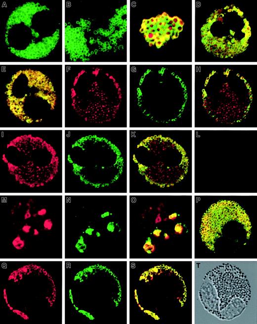 Fig. 1. Confocal laser scanning microscopy images of immunostained peripheral blood eosinophils of asthmatic subjects. / Representative images of human eosinophils stained with TRITC-conjugated secondary antibody (red) to detect the MBP as well as RANTES immunoreactivity, or BODIPY-FL–conjugated secondary antibody (green) to detect immunoreactivity against CD63. (A) Resting peripheral blood eosinophils labeled with BODIPY-FL indicating CD63 immunoreactivity. (B) Highly purified crystalloid granules immunostained with anti-CD63. (C) Higher magnification of a combined image of eosinophil crystalloid granules immunostained for MBP (TRITC) indicating core-associated immunoreactivity and CD63 indicating matrix-associated CD63 immunoreactivity. (D) Combined image of double immunofluorescence (MBP and CD63) staining of resting eosinophils; red (TRITC) represents immunoreactivity against MBP, and green (BODIPY-FL) is indicative of CD63 immunoreactivity. (E) Combined image of double immunofluorescence (RANTES and CD63) staining of resting eosinophils; TRITC detected RANTES, and BODIPY-FL detected CD63. (F-H) Double immunofluorescence (MBP and CD63) staining of IFN-γ–stimulated eosinophils (time = 10 minutes): MBP immunostaining (F), CD63 immunostaining (G), and combined image (H). (I-K) Double immunofluorescence (MBP and CD63) staining of C5a/CB-stimulated eosinophils (time = 10 minutes): MBP immunostaining (I), CD63 immunostaining (J), and combined image (K). (L) Combined image of isotype control for CD63 and MBP immunostaining. (M-O) Double immunofluorescence (MBP and CD63) staining of IL-3/IL-5/GM-CSF–stimulated eosinophils (time = 10 minutes): MBP immunostaining (M), CD63 immunostaining (N), and combined image (O). (P) Combined image of double immunofluorescence (MBP and CD63) staining of IFN-γ–stimulated eosinophils preincubated with genistein (10−6 M), which inhibited the IFN-γ–induced translocation of CD63. (Q-T) Double immunofluorescence (RANTES and CD63) staining of IFN-γ–stimulated eosinophils: RANTES immunostaining (Q), CD63 immunostaining (R), combined image (S), and DIC image of the same cell (T). Original magnification is × 630 for all images.