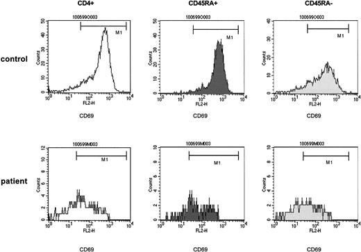Fig. 4. The impaired capability of T-helper cells to be induced to express CD69 upon nonspecific stimulation affects both the naive (CD4+CD45RA+) and the memory (CD4+CD45RA−) population after T-cell depletion. / PBMCs of control samples (upper panels) and of patient samples (lower panels) were stimulated with immobilized anti-CD3. At 24 hours of culture, T-helper cells were identified by anti-CD4 and gated and assessed for expression of CD45RA. The CD45RA+ and the CD45RA− populations were gated and separately analyzed for the expression of CD69. The density of expression of CD69 was estimated by the mpc in histogram plots. Patient samples were obtained from a 5-year-old boy with stage IV Ewing sarcoma (patient 15) 3 months after high-dose chemotherapy with autologous stem cell rescue. CD4+CD45RA+ cells, 126/μL.