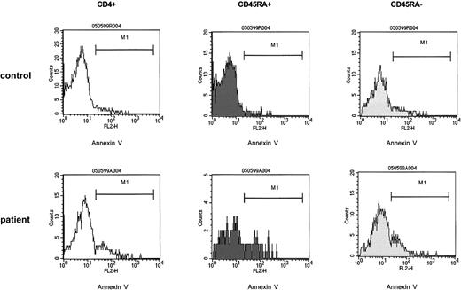 Fig. 6. In the post–T-cell depletion period the increased susceptibility to apoptosis affects both the naive (CD4+ CD45RA+) and the memory (CD4+ CD45RA−) T-helper cell population. / PBMCs of control samples (upper panels) and of patient samples (lower panels) were cultured in medium without the presence of T-cell stimulants (resting cultures) as described. At 24 hours of culture, T-helper cells were identified by anti-CD4 and gated and assessed for expression of CD45RA. The CD4+CD45RA+ and the CD4+CD45RA− populations were gated and separately analyzed for binding of annexin V. The percent annexin V binding cells were as follows: control CD4+ cells, 4%; control CD4+ CD45RA+ cells, 1%; control CD4+CD45RA− cells, 7%; patient CD4+ cells, 19%; patient CD4+CD45RA+ cells, 18%; patient CD4+ CD45RA− cells, 19%. The patient cells were obtained from a 12-year-old girl with Ewing sarcoma (patient 10) 3 months after completion of conventional high-dose chemotherapy. CD4+CD45RA+ cells, 60/μL.