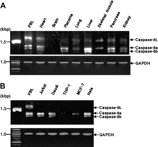 Fig. 2. RT-PCR analysis of the expression of caspase-8a, -8b, and -8L mRNA in normal human tissues and tumor cell lines. / (A) Complementary DNAs of selected human normal tissues (obtained from CLONTECH) were amplified by PCR with primers that detect caspase-8a, -8b, and -8L. (B) Total RNAs from human tumor cell lines were reverse transcribed and then amplified by PCR with the same primers used in panel A. The resulting PCR products were analyzed on 1.2% agarose gel and stained by ethidium bromide. Caspase-8a, -8b, and -8L fragments are indicated by arrows. As an internal control for RT-PCR, glyceraldehyde-3-phosphate dehydrogenase cDNA was amplified by PCR under the same experimental conditions and was used for normalization.