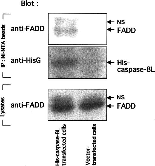 Fig. 8. In vivo interaction of caspase-8L with FADD in MCF-7 cell lines. / MCF-7 cells (2 × 107 cells) were transiently transfected with 4 μg empty vector (pcDNA3.1/HisA, Invitrogen) and His-tagged caspase-8L expression vector using LipofectAMINE (Life Technologies) as described in “Materials and methods.” Eighteen hours after transfection, cells were lysed and cleared by centrifugation. The supernatants were incubated with Ni-NTA Magnetic Agarose Beads, and Ni-NTA beads were collected using a magnetic separator. After washing, the proteins bound to His-tagged protein were eluted with SDS-PAGE buffer and fractionated by SDS-PAGE. In the upper column, eluates were blotted with anti-FADD antibody. In the middle column, eluates were blotted with anti-HisG antibody to confirm the binding of His-tagged caspase-8L to the Ni-NTA beads. In the bottom column, cell lysates of transfected MCF-7 cells were analyzed by SDS-PAGE and blotted with anti-FADD antibody. NS indicates nonspecific band.