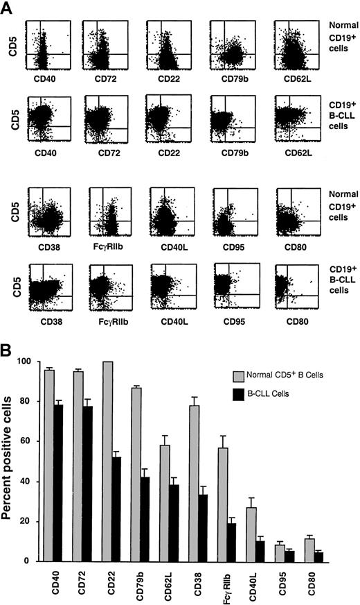 Fig. 2. Expression of surface membrane markers on B-CLL cells and normal CD5+ B cells. / Surface membrane markers underexpressed on B-CLL cells as compared with normal CD5+ B cells. PBMCs from B-CLL patients and age-matched healthy donors were analyzed for marker expression on CD5+CD19+ cells. (A) Representative flow cytometric profiles of expression of these markers on B cells from a 67-year-old healthy donor (N39) and CLL 308. (B) Paired bars depict the mean ± SE of the percentage of CD5+CD19+ cells expressing these markers in 51 IgM+ and 10 IgG+ B-CLL patients and 20 age-matched healthy controls. B-CLL cells expressed significantly lower percentages (P < .0001) of CD40, CD72, CD22, CD79b, CD62L, CD38, FcγRIIb, CD40L, CD95, and CD80 than normal CD5+CD19+ cells. The expression of these markers was variable both in the patients and in the markers, with the greatest variability seen for CD38. The SE and the SD for these markers ranged from 1.2 to 4.7 and from 8.9 to 35.5, respectively.