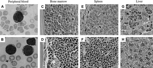 Fig. 2. Morphology of human leukemia cells in the murine peripheral blood and infiltrated tissues. / Murine (A) and original peripheral blood smear (B) from patient 17 showing similar morphology of leukemic blasts. Tissue sections of murine bone marrow (C,D), spleen (E,F), and liver (G,H) were prepared from mice engrafted with cells from patient 19 (C,E,G), and show replacement of the organ architecture with human leukemia cells compared with normal tissue (D,F,H). Arrows indicate foci of leukemic infiltration in the liver (G). Sections were prepared as described in “Patients and methods” and stained with hematoxylin and eosin. The levels of human cell engraftment (as quantified by the proportion of human versus mouse CD45+ cells) in the bone marrow, spleen, and liver of the mouse shown in panels C, E, and G were 98.5%, 92.6%, and 95.5%, respectively (data not shown). Original magnification × 1000 for panels A and B, × 200 for panels C through H.