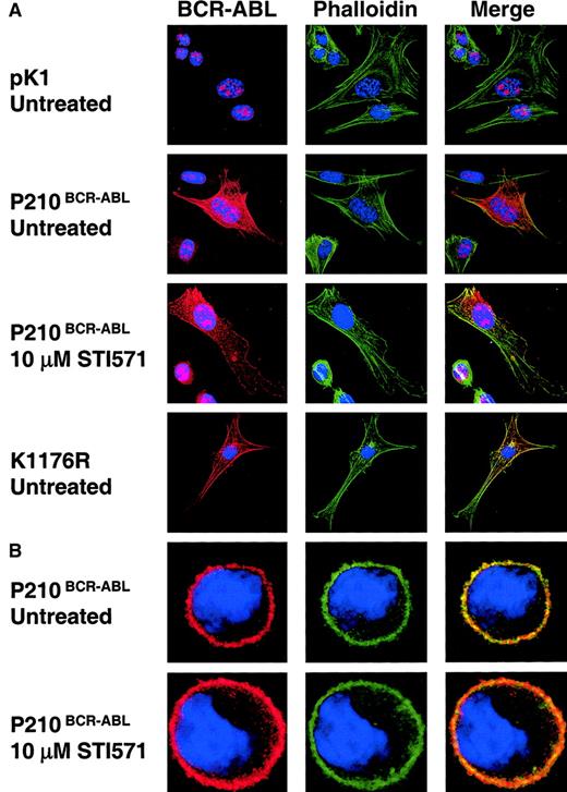 Fig. 7. The subcellular localization of P210BCR-ABL is independent of tyrosine kinase activity. / (A) NIH3T3 cells were transduced with pK1, P210BCR-ABL, or K1176R retroviral vectors and selected with puromycin to determine if F-actin colocalization is also independent of tyrosine kinase activity. Cells were attached to fibronectin-coated coverslips overnight in the presence or absence of 10 μM STI571 as indicated. (B) 32D cells expressing P210BCR-ABL or control pK1 (data not shown) were treated with 10 μM STI571 or an equal volume of PBS overnight in the presence of WEHI media containing IL-3. Cells were allowed to bind fibronectin-coated coverslips for 15 minutes prior to fixing and staining cells according to the same protocol used to prepare 32D cells for adhesion assays. 32D and NIH3T3 cells were imaged using confocal microscopy. Colocalization of BCR-ABL with F-actin appears yellow or orange when BCR-ABL (red) and actin (green) are merged. All cells were stained with DAPI to visualize the nucleus (blue). Positive nuclear staining observed in pK1-transduced control NIH3T3 cells is likely due to endogenous c-abl expression. Total magnification, × 120.