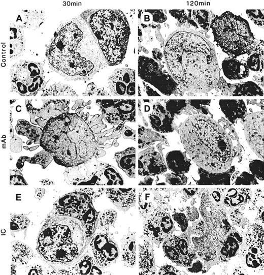Fig. 3. Spreading and adhesion of PMN onto tumor cells and cytolysis with hu14.18 and hu14.18/GM-CSF. / PMNs (200 000) were incubated with LA-N-1 neuroblastoma cells (10 000) alone (control) for (A) 30 minutes and (B) 120 minutes; with hu14.18 (mAb) for (C) 30 minutes and (D) 120 minutes; or with hu14.18/GM-CSF (IC) for (E) 30 minutes and (F) 120 minutes. Electron micrographs were taken with an original magnification of × 5400.