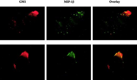 Fig. 6. Fluorescently labeled MIP-1β colocalizes with cell membrane GM1. / CEM-R5 cells were stained simultaneously with CT-B–AF594 and biotinylated–MIP-1β followed by avidin-fluorescein (FITC). The MIP-1β binding is shown in green and the CT-B–AF594 staining (equivalent to Texas Red) is shown in red. Colocalization is indicated by a yellow and/or orange color in the overlay panel. Representative examples of 2 images are presented. Magnification, × 500.