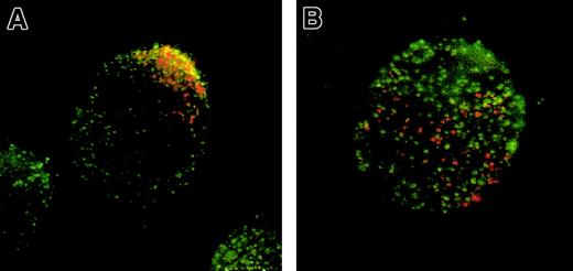 Fig. 7. Anti-CCR5 staining partially colocalizes with GM1. / CEM-R5 cells were stained with CT-B–AF594 followed by staining with the anti-CCR5 mAb, CTC5, in combination with GAM-AF488 (A,B). AF488 fluorescence is shown in green and CT-B–AF596 fluorescence is shown in red. Panel A represents a subpopulation of capped cells observed within the stained cells, whereas panel B represents a subpopulation of noncapped cells. As in Figure 6, colocalization is indicated by yellow and/or orange color. Magnification, × 500.