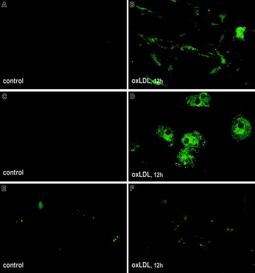 Fig. 3. Effect of oxLDL on translocation of PS to the outer leaflet of cell membranes. / Human SMCs (A,B), macrophages (C,D), and HAECs (E,F) were grown in Lab-Tek II chamber slides and incubated in the absence (A,C,E) or presence (B,D,F) of 100 μg/mL oxLDL for 12 hours. Exposure of PS on cell membranes was tested by immunofluorescence using annexin V coupled with EGFP as described in “Materials and methods.” Microscopy was performed using an Eclipse E800 microscope (Nikon) equipped with fluorescent filter blocks at magnification × 600.