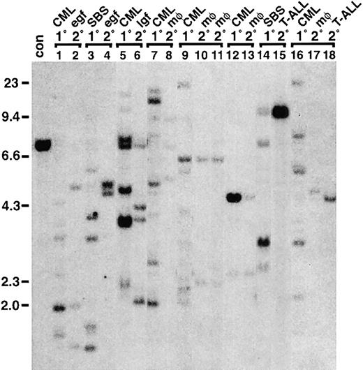 Fig. 8. Secondary transplant recipients in which graft failure or late-onset hematologic malignant disease develops have provirally marked clones from the primary animal. / Bone marrow and spleen cells from primary mice (1°) withTEL-ABL–induced SBS or CML-like disease (CML) were transplanted into lethally irradiated secondary recipients (2°). Genomic DNA from spleens of 2 secondary recipient mice that died with early graft failure (egf) and pancytopenia between 14 and 18 days after transplantation (lanes 1 and 2 and lanes 3 and 4) and from a recipient with late graft failure (lgf) that had pancytopenia and hypocellular bone marrow at 99 days after transplantation (lanes 5 and 6) contained provirally marked cells that shared some clones with myeloid cells from the primary mouse. Spleen DNA from several secondary recipient mice in which macrophage tumors developed (mφ) after long latent periods also shared proviral clones with myeloid cells from the donor (lanes 9, 10, and 11 and lanes 12 and 13), as did thymus DNA from a secondary recipient in which T-ALL developed (lanes 14 and 15). However, some macrophage tumors and cases of T-ALL that arose in secondary recipients were derived from proviral clones that were not represented at significant levels in the myeloid cells of the donor (lanes 16, 17, and 18).