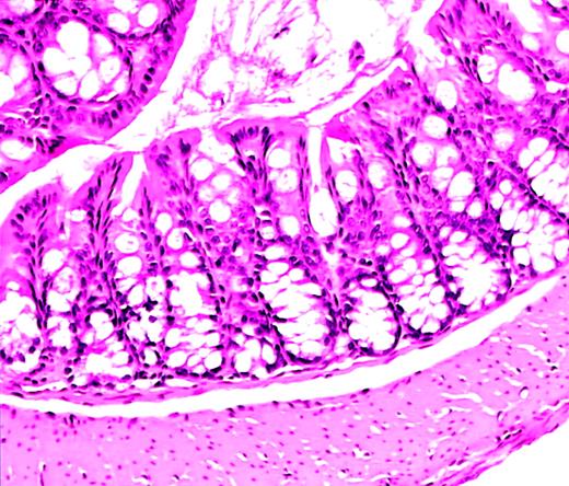 Fig. 1. Normal colon histology in C57−WAS− mouse after transplantation. / Hematoxylin and eosin–stained section from the colon of a C57/BL6J WAS-null mouse (age 10 weeks, H hepaticuspositive) that became acutely ill and was killed 10 days after lethal irradiation and bone marrow transplantation. A severe hemorrhagic cystitis was found at necropsy. Colon histology shows rare acute and chronic inflammatory cells, but is essentially normal. Magnification, × 50.