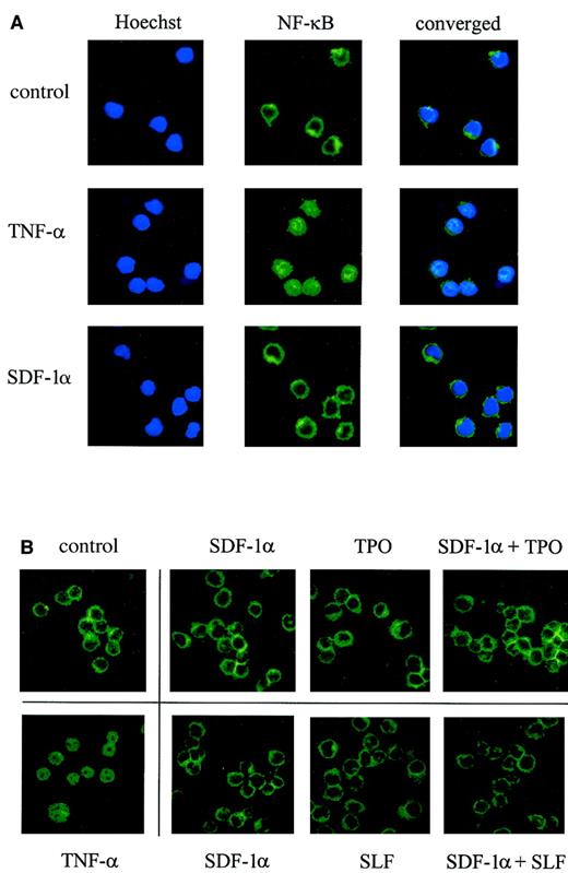 Fig. 6. No effect of SDF-1α or other cytokines on translocation of NF-κB. / Factor-starved MO7e cells were stimulated with SDF-1α alone, other cytokines alone, or combinations of cytokines for 15 minutes, and the cellular localization of NF-κB was determined by confocal microscopy after staining with a mAb against human NF-κB p65. Nuclei were stained by Hoechst no. 33258. Cells treated with TNF-α (15 minutes) are shown as a positive control for NF-κB nuclear translocation. Magnification, × 100.