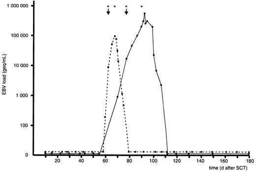 Fig. 2. Viral load following therapy for established EBV-LPD. / EBV load in 2 recipients of a TCD allo-SCT with established EBV-LPD prior to planned preemptive therapy. EBV-LPD was diagnosed on lymph node biopsies in both patients at the day of first rituximab infusion. Both patients developed a sustained complete response after 2 successive infusions of rituximab combined with dose reduction of cyclosporin (↓ denotes diagnosis of EBV-LPD; asterisk indicates single infusion of 375 mg/m2 rituximab).