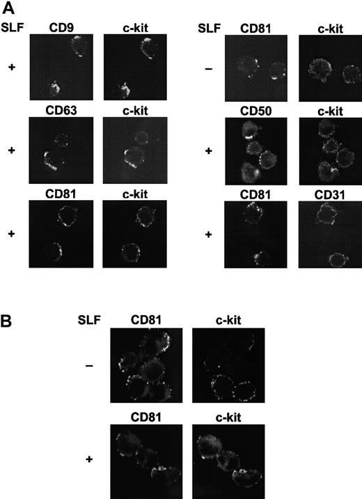 Fig. 10. Colocalization of TM4SF molecules with c-kit. / (A) MO7e cells were treated with or without 50 ng/mL SLF for 60 minutes at 37°C. Cell surface TM4SF molecules or CD50 were cross-linked first with primary mAbs and then with FITC-conjugated antimouse antibody and allowed to cap at 37°C. The cells were then stained with biotin-labeled anti–c-kit or -CD31 mAbs and TRITC-conjugated streptavidin. Fluorescence intensities from FITC (left column) and TRITC (right column) were separately determined by a confocal laser scanning microscopy. These are the representative results from 3 separate experiments. (B) Cord blood CD34+ cells were incubated with IL-6, TPO, and Flt3 ligand for 3 days. The cells were treated with or without 50 ng/mL SLF for 60 minutes at 37°C. After capping induction with FITC-conjugated anti-CD81 mAb and purified antimouse antibody, the cells were stained with biotin-labeled anti–c-kit mAb and TRITC-conjugated streptavidin, and visualized by confocal laser scanning microscopy. These are the representative results from 2 separate experiments.