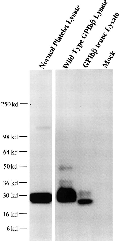 Fig. 1. MoAb 257.4 recognition of an epitope in the N terminus 80 residues of GPIbβ. / The recombinant proteins GPIbβ and GPIbβ-trunc9 were expressed in HEK293T cells. The cells were lysed, analyzed by SDS-PAGE, and immunobloted with MBC 257.4. Lane 1 shows platelet lysate; lane 2, recombinant wildtype GPIbβ; lane 3, recombinant GPIbβ-trunc.9 The epitope for MBC 257.4 is within the N terminus 80 residues of GPIbβ.