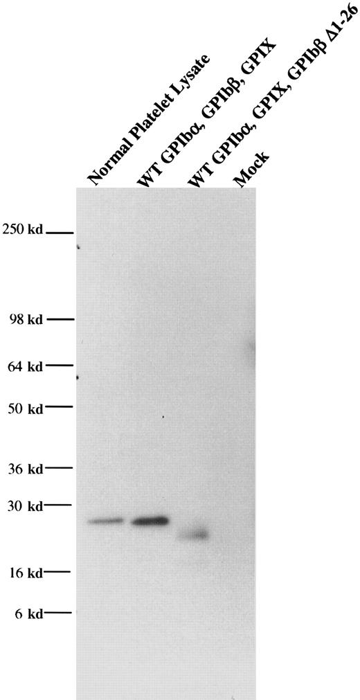 Fig. 5. GPIbβΔ1-26 complexed with GPIbα. / GPIbβ truncated at residue 26 and wildtype GPIbα were simultaneously transfected into HEK293T cells. The cells were immunopreciptated with an anti-GPIbα antibody and immunoblotted with an anti-GPIbβ polyclonal antibody. This demonstrated that GPIβΔ1-26 is complexed with GPIbα.