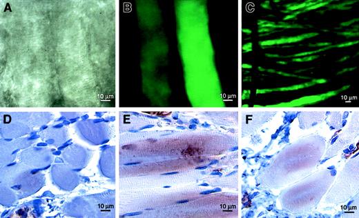 Fig. 2. VEGF-D expression in vivo. / In situ gene transfer to rat cremaster muscle was confirmed by direct visualization of GFP using confocal fluorescence microscopy. Discrete muscle fibers were visualized using phase-contrast (A) and fluorescence (B, C) microscopy 5 days after the injection of Ad-GFP. Immunostaining for VEGF-D revealed maximum expression 5 days (E) and detectable levels 21 days (F) after the injection of Ad-VEGF-DΔNΔC but not of control Ad-GFP (D). Positive staining was observed in muscle fibers, fibroblasts, and blood vessel walls.