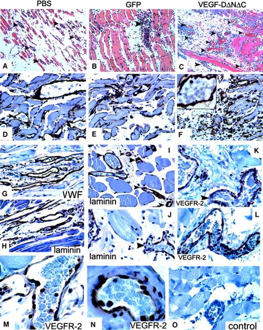 Fig. 4. Analysis of the response in the cremaster muscle to Ad-VEGF-DΔNΔC. / (A-C) Tissue sections of cremaster muscle 5 days after injection (hematoxylin and eosin staining; ×20 objective). (A) PBS induced moderate interstitial edema surrounding skeletal muscle. No vascular proliferation was seen. (B) Ad-GFP induced chronic inflammation consisting of lymphocytes and tissue monocytes with mild interstitial edema. No significant vascular proliferation. (C) Ad-VEGF-DΔNΔC induced interstitial edema and a central focus of vessels with the appearance of venous channels. Blood vessels are indicated by arrowheads. (D-F) Sections taken 3 weeks after injections were stained for laminin. Ad-VEGF-DΔNΔC induced a distinct increase in the number of laminin-positive blood capillaries; ×40 objective. (F) Higher magnification (×100 objective) is shown in the inset. Arrows indicate blood vessels. (G-L) Pairs of serial tissue sections from cremaster muscle 21 days after Ad-VEGF-DΔNΔC injection were stained for VWF (G) and laminin (H) and for VEGFR-2 (K, L) and laminin (I, J). A wide range of vascular, blood-filled, irregular venous channels could be identified between muscle fibers. Some were thin-walled with a single EC layer between the lumen and adjacent tissue. Blood vessels (bv) are shown and in some cases are denoted by arrowheads. Panels G-L, ×50 objective. (M, N) VEGFR-2 expression 21 days after treatment with Ad-VEGF-DΔNΔC. (O) Negative control. Panels M-O, ×100 objective.