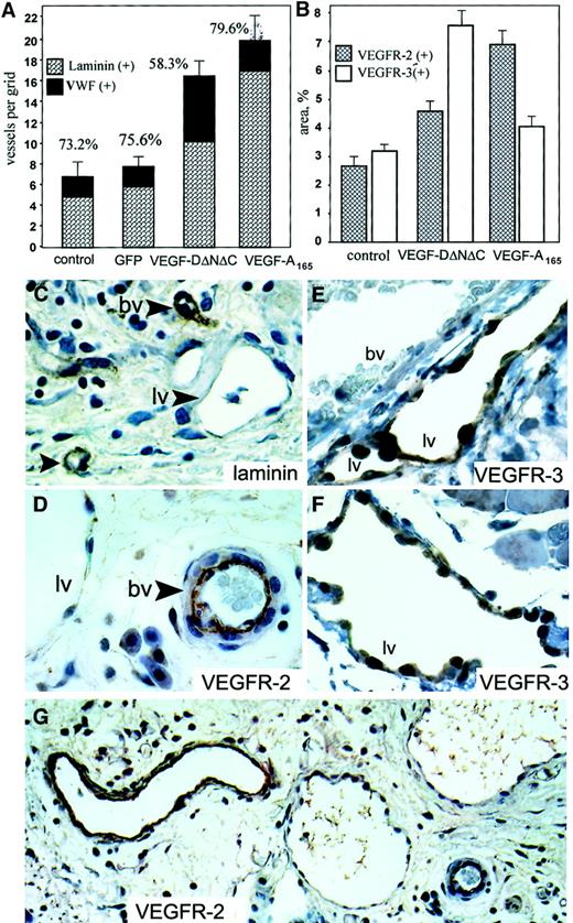 Fig. 6. Angiogenesis and lymphangiogenesis induced by Ad-VEGF-DΔNΔC in skin. / Tissue sections were taken 3 weeks after injection of PBS, Ad-GFP, Ad-VEGF-DΔNΔC, or Ad-VEGF-A165. (A) Serial sections were stained for VWF, and laminin and positive vessels per field were quantified. A 100% value was assigned to VWF-positive vessels, and percentages denote the proportion of vessels that were also laminin positive. Bars represent means ± SE for 3 separate tissue samples in each group. (B) Sections were stained for VEGFR-2 and VEGFR-3, and vessel areas were measured using a 10 × 10 graticule. All areas in 4 × 20-mm tissue samples were analyzed. Bars represent percentages of area covered by positively stained vessels ± SE. Note the predominant formation of VEGFR-2–positive vessels after Ad-VEGF-A165 injection and VEGFR-3–positive vessels induced by Ad-VEGF-DΔNΔC. (C-G) Samples 3 weeks after injection of Ad-VEGF-DΔNΔC. Tissue sections stained for laminin (C), VEGFR-2 (G; higher magnification of the same area in D; ×20 objective), and VEGFR-3 (E, F) are shown. Blood vessels (bv) and lymphatic vessels (lv) are indicated. Lymphatic channels with single endothelial cell layer were not stained for laminin (C) or for VEGFR-2 (D), but they demonstrated significant expression of VEGFR-3 (F). Note the absence of VEGFR-3 staining of vessels filled with red blood cells (E). Panels C-F, ×50 objective.