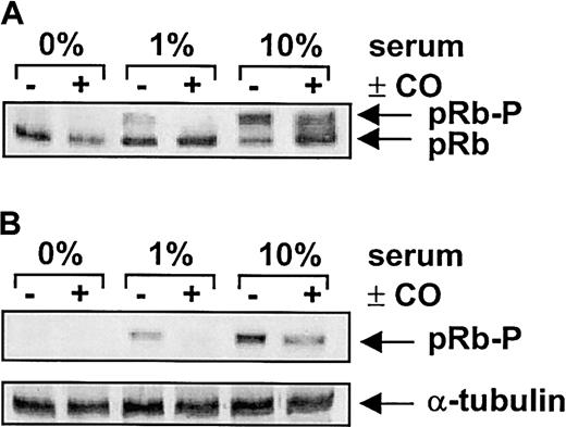 Fig. 7. Effect of CO on retinoblastoma phosphorylation in vascular SMCs. / Cells were treated with serum (0%-10%) and SnPP (20 μM) for 24 hours in the presence and absence of CO (100 ppm) and retinoblastoma expression determined using an antibody that recognizes both the hypophosphorylated (pRb) and hyperphosphorylated (pRb-P) forms of pRb (A) or a phosphorylation-specific pRb antibody (B). Similar findings were observed in 4 separate experiments.
