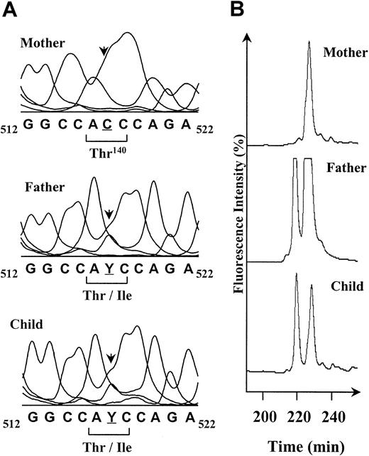 Fig. 2. Direct sequence analysis and SSCP profiles of amplified exons 4 of GP IIIa DNAs from the mother Duv, the father, and their child. / (A) The genomic DNA sequences corresponding to the region 512 to 522 of the GP IIIa cDNA are shown. The mother is homozygous for the C517 (underlined), and the father and the child are C/T heterozygous (Y). The C>T base change results in a Thr (ACC) for an Ile (ATC) substitution at the amino acid 140 of the mature GP IIIa. The polymorphic position is indicated by an arrow. (B) The interesting part of the SSCP profiles of the exon 4–PCR products obtained for the reverse DNA single strand at 20°C is shown. The peak detected at 230 minutes in the mother's profile corresponds to the C517 allele of the GP IIIa. The peak at 220 minutes obtained for the father and the child is specific for the T517 form. SSCP confirms the father and the child are heterozygous for the C>T mutation.
