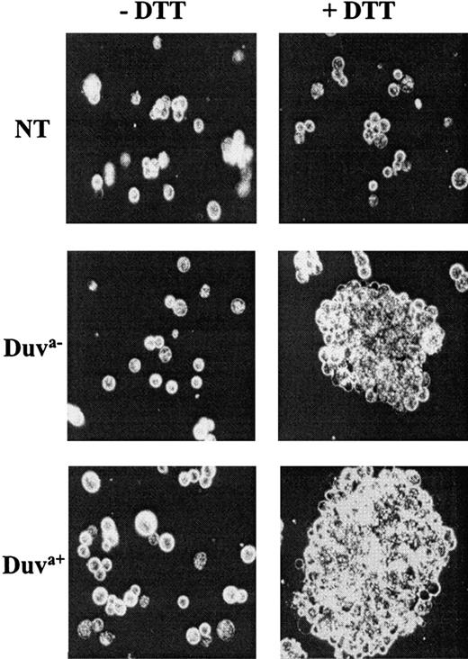 Fig. 6. Aggregation of transfected CHO cells. / Cells not transfected (NT) or expressing the Duva− or Duva+ allelic forms of the GP IIb-IIIa were treated by 10 mM DTT (+DTT) for 20 minutes at room temperature to activate the complex prior to being incubated with 100 μg/mL fibrinogen in the presence of 2 mM calcium with gentle shaking for 20 minutes. Only Duva− and Duva+ cells aggregated in the presence of fibrinogen when treated by DTT. No significant aggregation was observed for nontreated cells (−DTT) or nontransfected cells treated or not. The specimens were examined with a Leica-Orthoplan fluorescence microscope (Leica, Wetzlar, Germany) using a ×40 oil immersion objective. Microphotographs were taken using Ilford HP5 400 films (ILFORD Imaging, Mobberley, Cheshire, United Kingdom).
