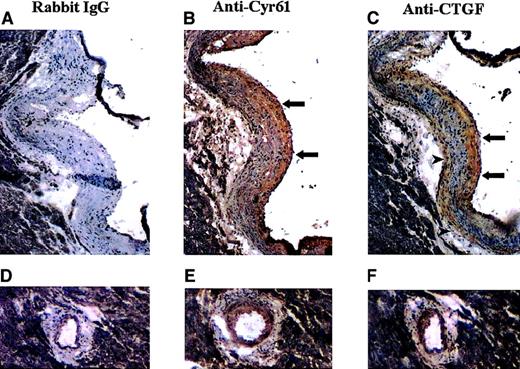 Fig. 1. Immunohistochemical localization of Cyr61 and CTGF in advanced atherosclerotic lesions of ApoE−/− mice. / Frozen serial sections were taken from the heart at the aortic valve where prominent atherosclerotic lesions had formed. Sections were treated with H2O2, blocked with normal goat serum, and incubated with normal rabbit IgG (A,D), anti-Cyr61 (B,E), or anti-CTGF (C,F). Antibody localization was detected with a biotinylated secondary antibody, followed by the avidin-biotin-HRP labeling system using diaminobenzidine as the substrate. The sections were counterstained with hematoxylin and eosin. Lesions located at the aortic valve (A-C) and coronary artery (D-F) are shown.