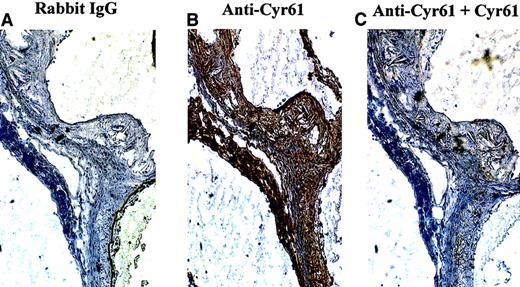 Fig. 2. Specificity of immunohistochemical staining of Cyr61 in mouse atherosclerotic lesions. / Frozen serial sections, taken from the hearts of ApoE−/−mice, were incubated with rabbit IgG (A) or anti-Cyr61367–381 (B,C). To demonstrate staining specificity in panel C, anti-Cyr61367–381 was preabsorbed with 5 μg/mL recombinant Cyr61 for 16 hours at 4°C prior to its application to the sections. Immunohistochemical staining was performed as described in the legend of Figure 1.