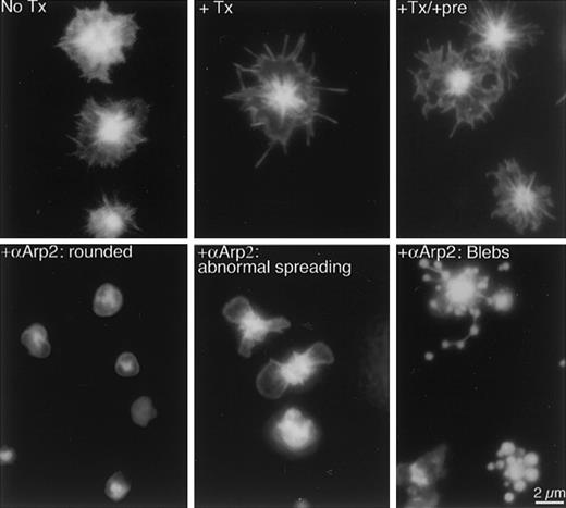 Fig. 3. αArp2 inhibits filopodia and lamellipodia formation during spreading on glass. / Platelets were either directly spread on glass in plasma or were permeabilized briefly first with or without antibodies, and then mounted on glass. After 20 minutes, adherent platelets were fixed in the presence of FITC–phalloidin to stabilize and stain the F-actin. Top row of micrographs shows representative examples of spread platelets under 3 control conditions: no treatment (No Tx), permeabilized (+Tx), and permeabilized and loaded with preimmune antibodies (+Tx/+pre). The lower row of micrographs shows representative examples of platelets permeabilized and loaded with αArp2 before exposure to glass (+αArp2). Typical effects are frozen at the rounded stage (left panel), abnormal lamellipodia (middle panel), and blebbing (right panel).