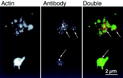 Fig. 5. αArp2 antibody is detected in the cytoplasm after permeabilization. / Representative examples of platelets permeabilized, loaded with αArp2, activated on glass, and fixed as in Figure 3. After fixation, platelets were stained with Cy3-labeled secondary antibody to determine whether the primary antibody gained access to the cytoplasm during permeabilization. Staining for αArp2 (red) and actin filaments with FITC–phalloidin (green) demonstrates diffuse speckling in the cytoplasm with some larger aggregates of antibody (arrows).