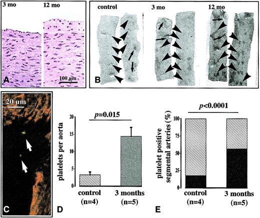 Fig. 1. Hypercholesterolemia-induced platelet recruitment to lesion-prone sites in vivo as established by a platelet homing assay. / (A) Rabbit thoracic aortas developed prominent lesions after 12 months of a 0.125% cholesterol diet (right panel), whereas after 3 months no lesions were observed in hematoxylin/eosin staining (left panel). (B) Sudan black staining revealed no detectable lesions in en face preparations of control and 3 mo aortas (left and middle panels) used to quantify platelet homing, whereas 12 mo aortas (right panel) displayed profound lesion development at segmental artery branching points; arrows indicate mesenteric artery ostia; arrowheads, segmental artery ostia. (C) Following injection of autologous platelets labeled with the fluophor CTG, the aortas were dissected after 72 hours. They were counterstained with 1 μM CTR to facilitate recognition of the endothelial plane in en facescanning confocal microscopy. Homed platelets are detected by FITC-fluorescence and display fluorescent double-staining appearing yellow (arrows). (D) Five-fold more platelets were recruited to lesion-prone sites of cholesterol-fed rabbits compared to controls. No platelets were detected at the anterior aspect of the aorta or elsewhere outside of branching points. (E) In diet rabbits the likelihood for a segmental artery ostium to recruit platelets in 72 hours was significantly increased.
