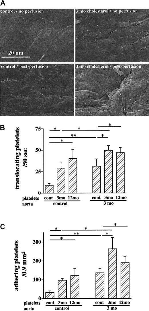 Fig. 2. Augmented platelet recruitment in response to hyperlipidemia. / Segments of the thoracic aorta were mounted face down in a flow chamber and perfused at 24 dynes/cm2 with reconstituted blood spiked with 10 000 platelets/μL that had been labeled with BCECF-am. (A) Hypercholesterolemia itself already induced a more irregular appearance of the endothelial monolayer (upper panels). The endothelial monolayer remained intact but the perfusion protocol induced slight morphologic changes, as evidenced by the rougher endothelial surface after perfusion in scanning electron microscopy, which were not different between groups (lower panels). (B,C) Hypercholesterolemia caused platelet activation as evidenced by increased translocation and firm adhesion of platelets isolated from rabbits on the diet for 3 months (3 mo) compared to control platelets on control aortas. Interestingly, the presence of lesions in the arterial tree of rabbits on the diet for a year (12 mo) did not further augment platelet translocation. Superfusion of control platelets over aortas from cholesterol-fed rabbits demonstrated an independent role for endothelial activation in response to hyperlipidemia. Endothelial and platelet activation were additive in augmenting the interaction (*P < .05; **P < .01).