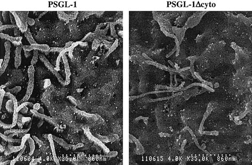 Fig. 8. Cell surface distribution of PSGL-1 and PSGL-1Δcyto on transfected K562 cells is indistinguishable. / High-power (original magnification × 8000) photomicrographs of PSGL-1 transfectants (left panel) and PSGL-1Δcyto transfectants (right panel). Both transfectants showed a similar and uniform distribution of KPL1 immunogold particles on the microvilli and cell body. Scale bar is 860 nm.