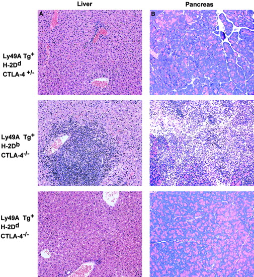 Fig. 3. Ly49A transgene interaction with H-2Ddprevents the infiltration of lymphocytes into nonlymphoid tissues in CTLA-4–deficient mice. / Dramatic infiltration of the nonlymphoid tissues was observed in the CTLA-4−/− mice expressing the Ly49ATg in the absence of MHC class I-Dd, whereas there was no apparent T-cell infiltration in the Ly49ATg+ H-2DdCTLA-4−/− mice. Tissues were fixed in 10% buffered formalin and embedded in paraffin blocks. Sections were cut and stained with hematoxylin and eosin by conventional techniques. The representative data shown (of > 10 independent experiments) are tissue sections from liver (A) and pancreas (B) of animals 3.5 weeks of age. No overt lymphocytic infiltration into nonlymphoid tissue was observed in the Ly49ATg+ H-2DdCTLA-4−/− mice at 5 to 6 weeks of age (data not shown). Magnification, × 250.
