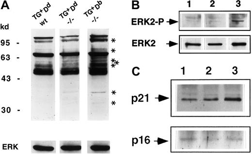 Fig. 5. Ly49A-mediated inhibitory signals diverge and converge with the CTLA-4 signaling pathway. / (A) Total tyrosine phosphorylation in lysates of purified lymph node T cells ex vivo. Lysates were equalized for total protein content and the proteins were separated by sodium dodecyl sulfate–polyacrylamide gel electrophoresis (SDS-PAGE; 8%; lane 1: Ly49ATg+Dd CTLA-4+/+,+/−; lane 2: Ly49ATg+Dd CTLA-4−/−; lane 3: Ly49ATg+Db CTLA-4−/−). The phosphoproteins were detected by Western blotting using antiphosphotyrosine antibody 4G10. These data are representative of 7 independent experiments. Asterisks indicate bands uniquely phosphorylated in the CTLA-4−/− T cells from mice that develop lymphoproliferation but not in the “rescued” (Ly49ATg+/− Dd) CTLA-4−/− or in the littermate control animals. (B) Phosphorylated ERK2 was detected by Western blot total protein with anti-EK2 tyrosine phosphorylation–specific antibody. The blots in panels A and B were stripped and reprobed with anti-ERK2 antibody (lanes are as indicated in panel A ). This is representative of 3 independent experiments. (C) CD3ζ phosphorylation. Lysates of equivalent total protein were immunoprecipitated by anti-CD3ζ antibody 387. Immunoprecipitates (lanes are as indicated in panel A) were separated by SDS-PAGE (12%) and phosphoproteins were detected by Western blotting using antiphosphotyrosine antibody 4G10. The blots were stripped and reprobed with anti-CD3ζ antibody. This is representative of 3 independent experiments.