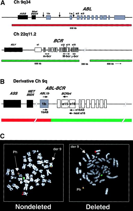 Fig. 1. Probe sets and images for the detection of deletions of the derivative chromosome 9. / (A) Structure of the ABL and BCR loci showing the common breakpoints (arrows) and the probes used in the dual-color, dual-fusion detection system. ASS indicates arginine succinate synthetase; Met8604, Met8604 gene; IGLV, immunoglobulin lambda light chain locus. (B) A representativeABL-BCR (1b-b4) rearrangement is shown on the derivative chromosome 9 with the position of the ABL1b,BCRb4, 1bAB, e16AB, and neste16 primers and the FISH fusion signal. (C) Fluorescence in situ hybridization (FISH) analysis of nondeleted and deleted Ph+ metaphase cells. In both cells, the normal chromosome 9 and 22 demonstrate a single red and green signal, respectively, with a fusion signal present on the Ph+ cell. In the nondeleted cell, the derivative chromosome 9 also demonstrates a fusion signal, but this is missing from the derivative chromosome 9 in the deleted cell.