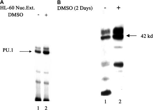 Fig. 9. Effect of DMSO-induced differentiation of HL-60 cells on levels of PU.1 protein. / (A) EMSA of DMSO-induced cells. HL-60 cells were incubated with or without 1.25% DMSO for 38 hours, and nuclear extracts were prepared. EMSA was carried out with 5 μg nuclear extracts using the32P-labeled p40phox PU.1a DNA probe. Specific PU.1-containing complexes are indicated by the arrow. (B) Immunoblot analysis of DMSO-induced cells. HL-60 cells were incubated with or without 1.25% DMSO for 38 hours, and equal amounts of protein from whole cell lysates were separated by SDS-PAGE and analyzed by immunoblotting with specific antibody to PU.1. The 42-kd form of the protein is indicated by the arrow. The slower-migrating band probably corresponds to a hyper-phosphorylated form of the protein.6768