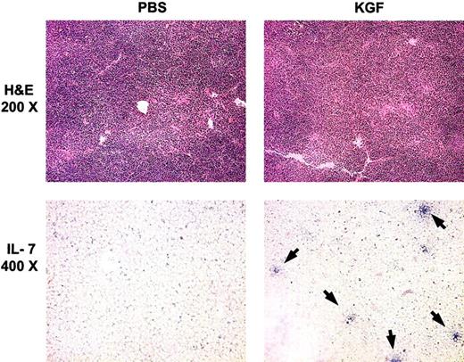 Fig. 7. KGF pretreatment increases the number of IL-7–producing TECs. / Top panels, hematoxylin-eosin (H & E) staining of thymic sections from congenic BMT recipients (1400 cGy) at day 28 after BMT. Lower panels, in situ hybridization for intrathymic IL-7 transcripts from the same mice as for H & E stains. Arrows indicate IL-7+ cells.